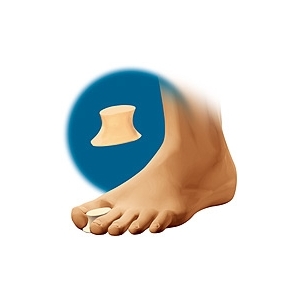 SEPARADOR GRUESO DE...